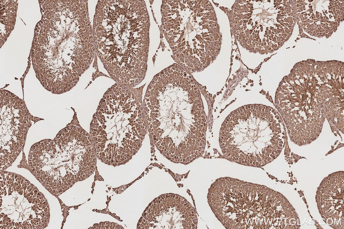 Immunohistochemical analysis of paraffin-embedded rat testis tissue slide using KHC2894 (CEP44 IHC Kit).