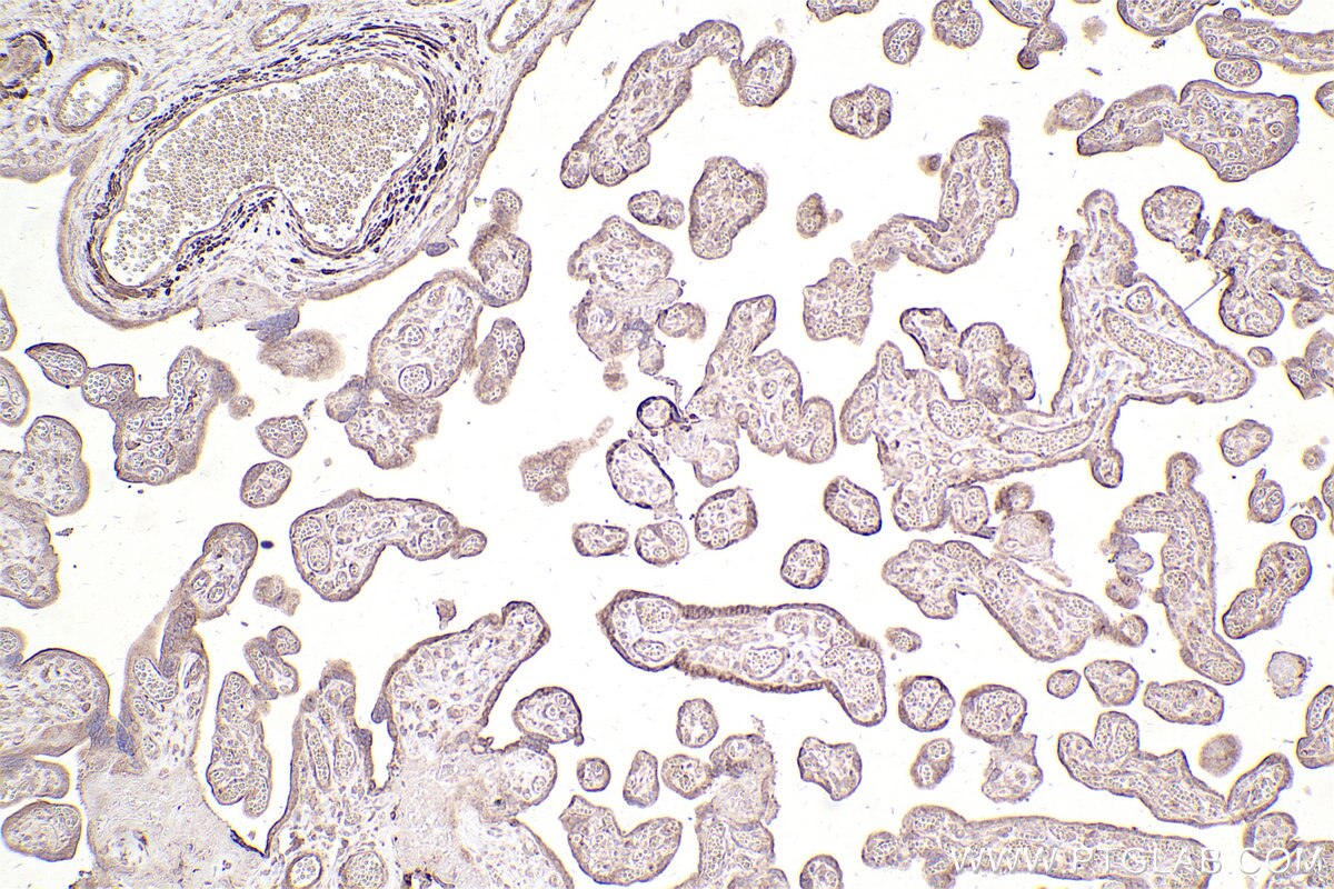 Immunohistochemical analysis of paraffin-embedded human placenta tissue slide using KHC2533 (CEP55 IHC Kit).
