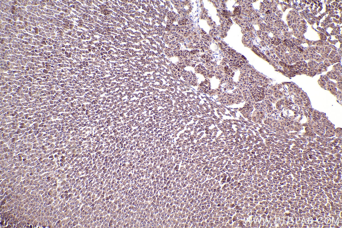 Immunohistochemical analysis of paraffin-embedded rat adrenal gland tissue slide using KHC2533 (CEP55 IHC Kit).