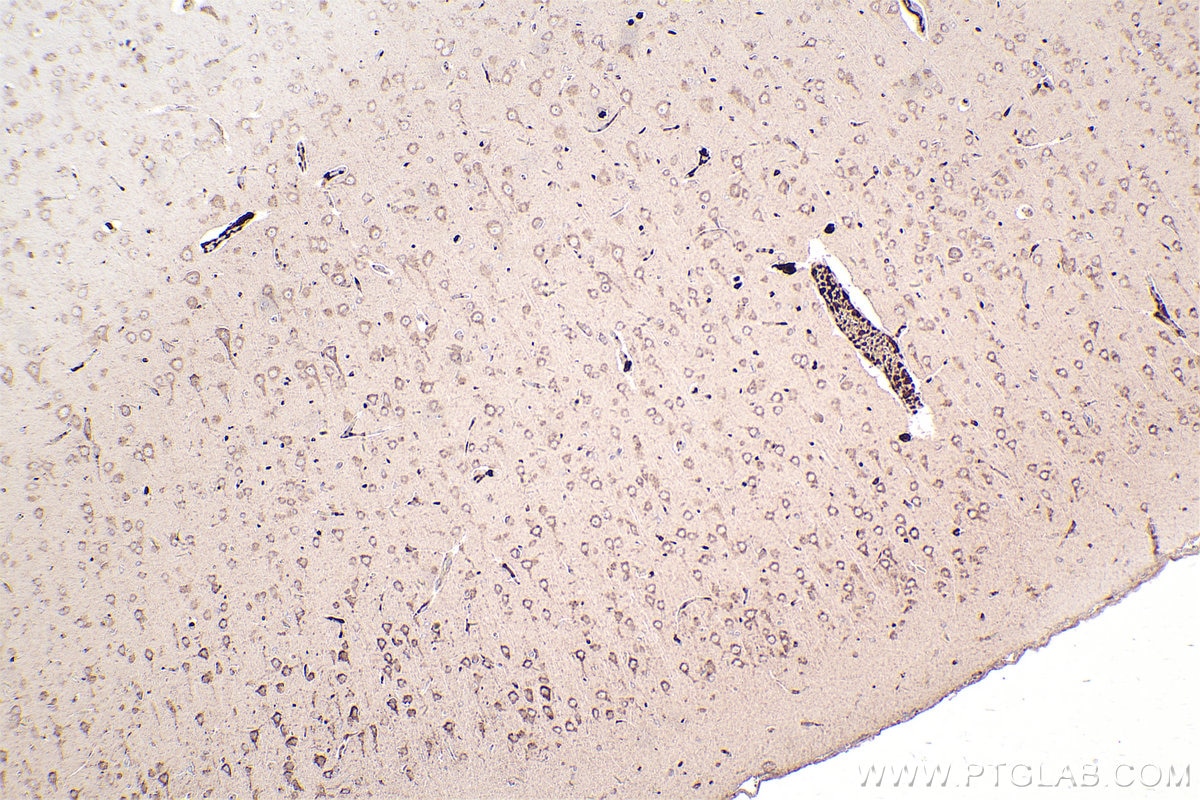 Immunohistochemical analysis of paraffin-embedded rat brain tissue slide using KHC2533 (CEP55 IHC Kit).