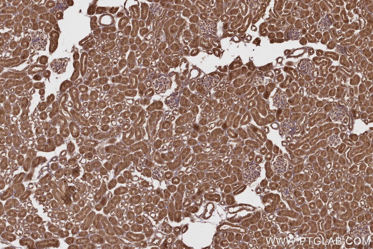 Immunohistochemical analysis of paraffin-embedded mouse kidney tissue slide using KHC2807 (CEP63 IHC Kit).