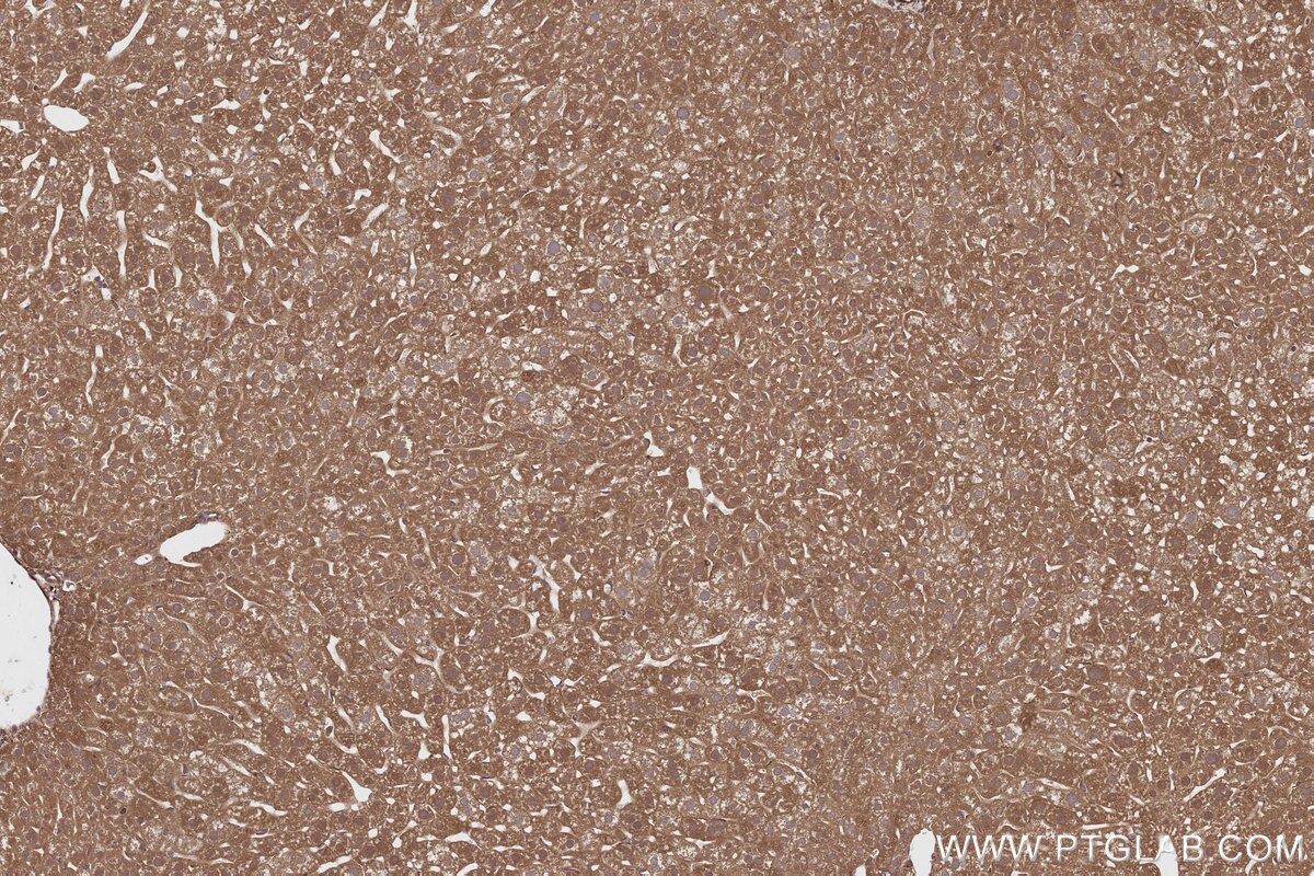 Immunohistochemical analysis of paraffin-embedded mouse liver tissue slide using KHC2807 (CEP63 IHC Kit).