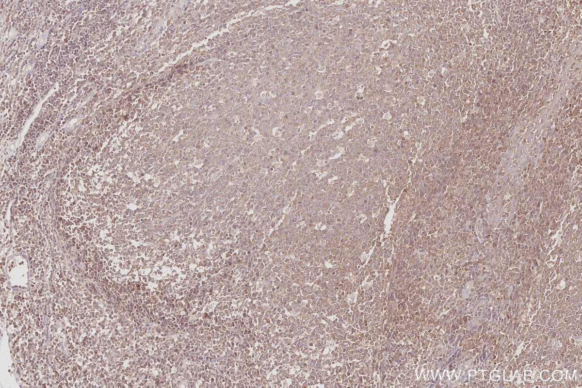 Immunohistochemical analysis of paraffin-embedded human tonsillitis tissue slide using KHC3093 (CEPT1 IHC Kit).