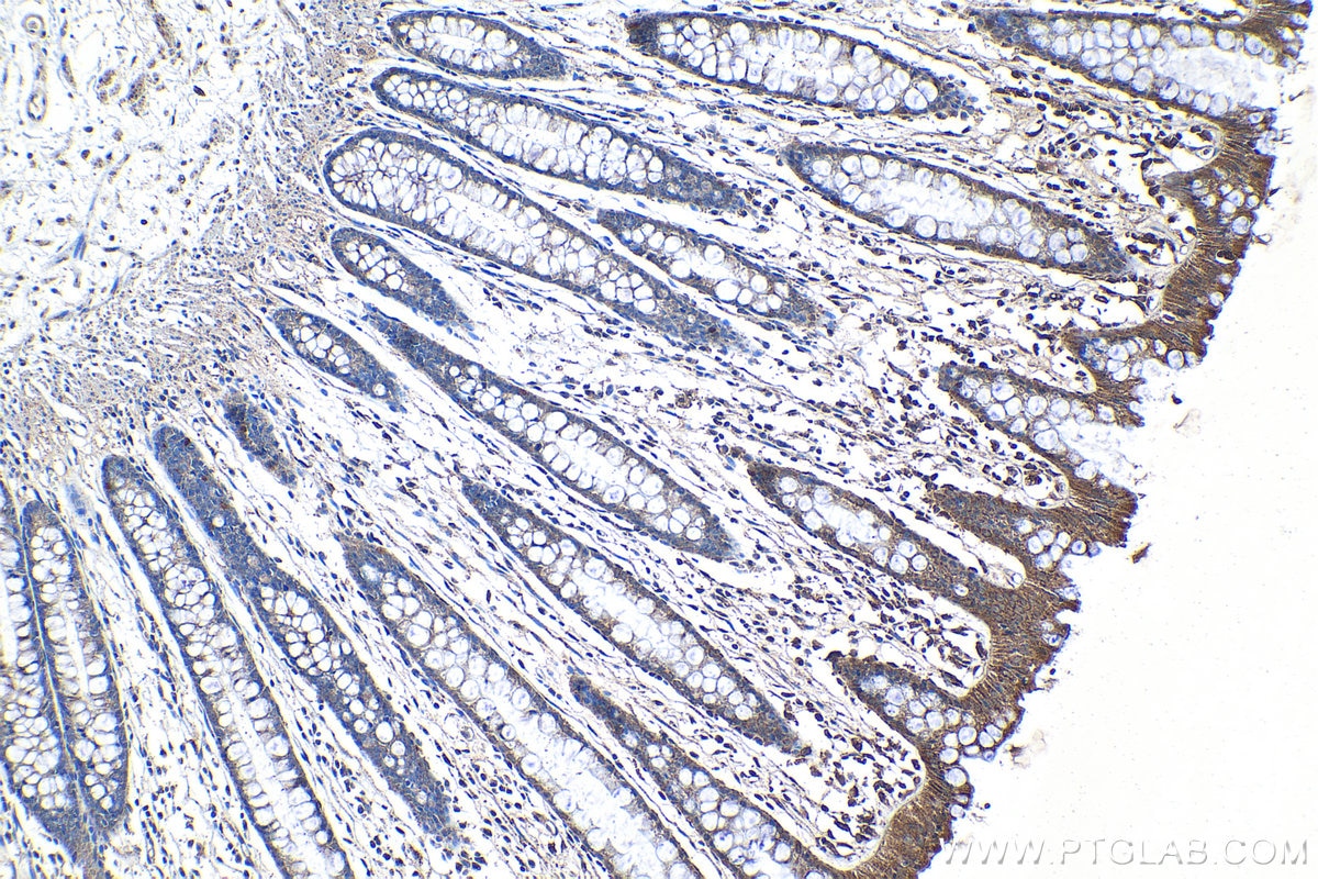 Immunohistochemical analysis of paraffin-embedded human colon tissue slide using KHC1280 (CERCAM IHC Kit).