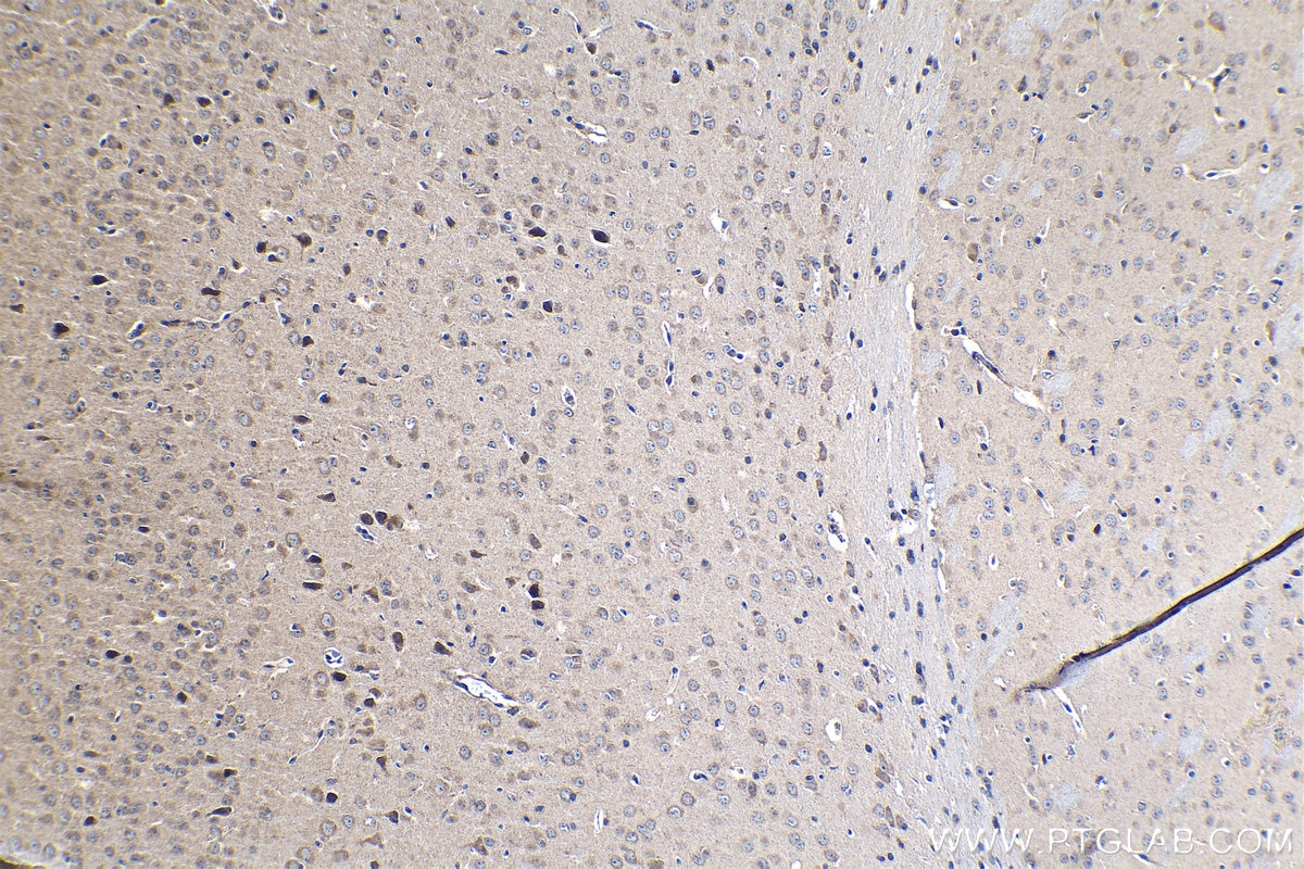 Immunohistochemical analysis of paraffin-embedded mouse brain tissue slide using KHC1280 (CERCAM IHC Kit).