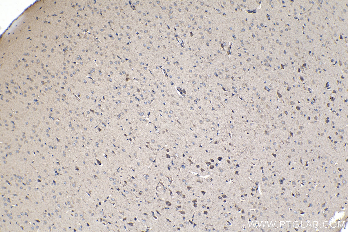 Immunohistochemical analysis of paraffin-embedded rat brain tissue slide using KHC1280 (CERCAM IHC Kit).