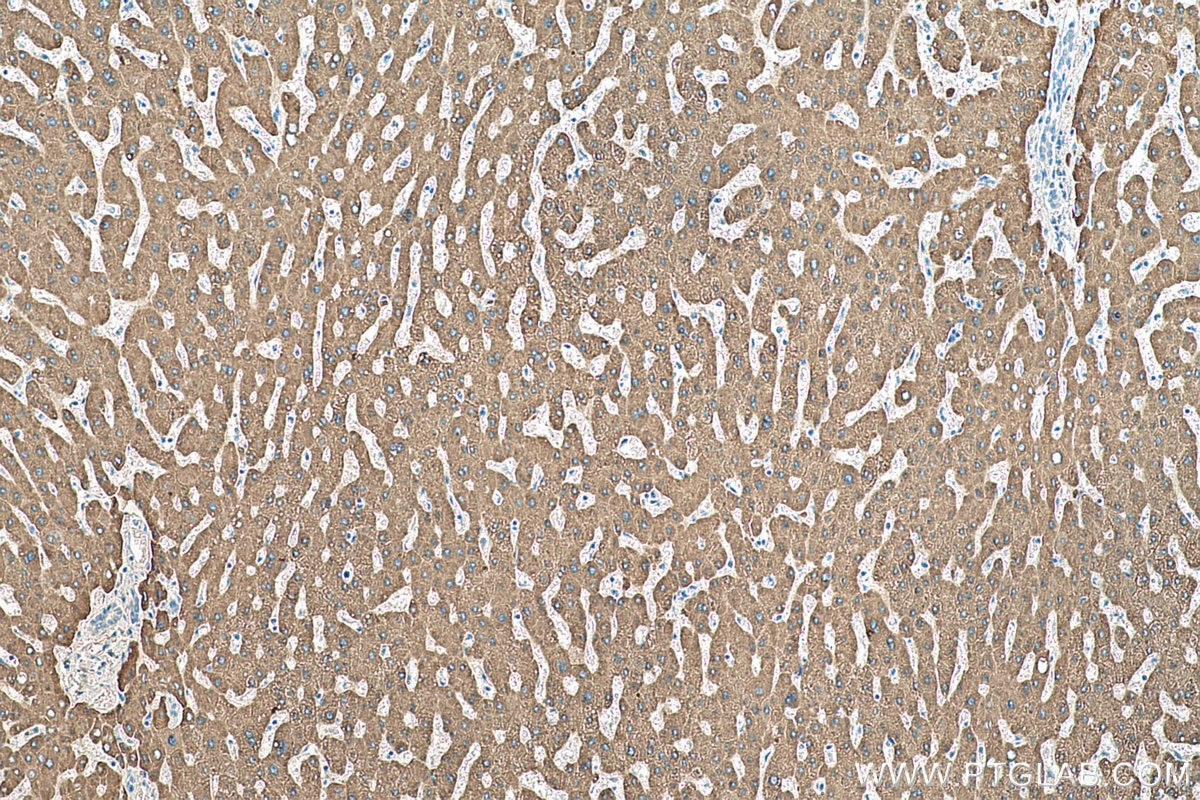 Immunohistochemical analysis of paraffin-embedded human liver tissue slide using KHC0503 (CES1 IHC Kit).