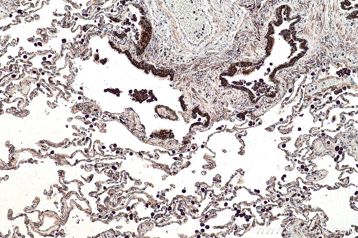 Immunohistochemical analysis of paraffin-embedded human lung tissue slide using KHC0503 (CES1 IHC Kit).