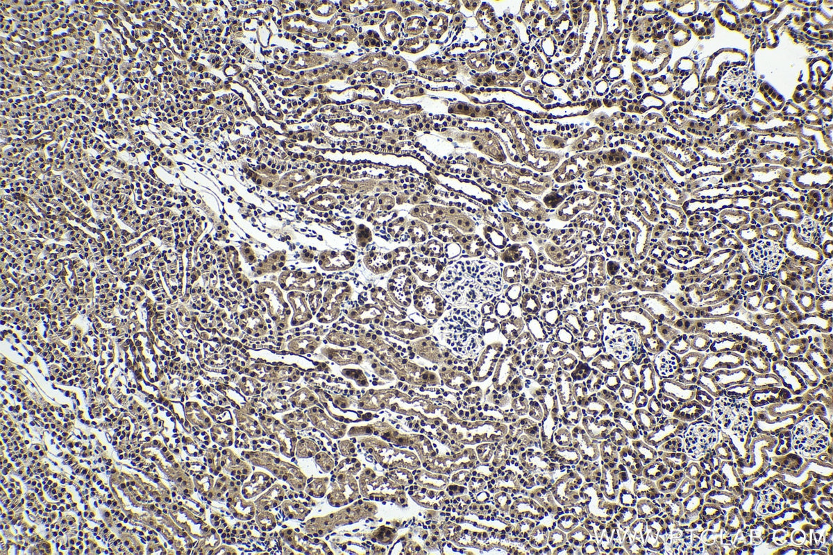 Immunohistochemical analysis of paraffin-embedded mouse kidney tissue slide using KHC1607 (CETN2 IHC Kit).