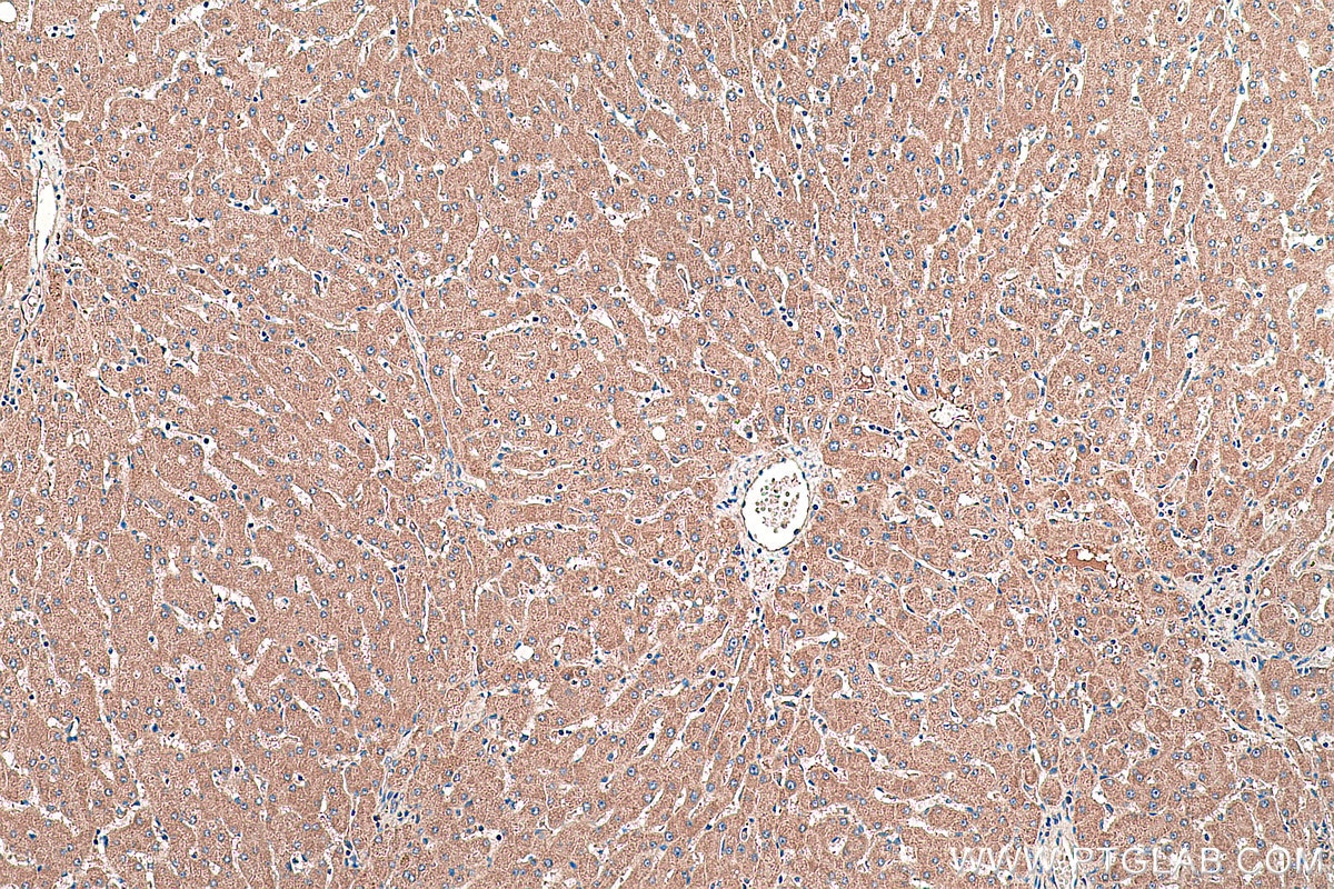 Immunohistochemical analysis of paraffin-embedded human liver tissue slide using KHC0409 (CFH IHC Kit).