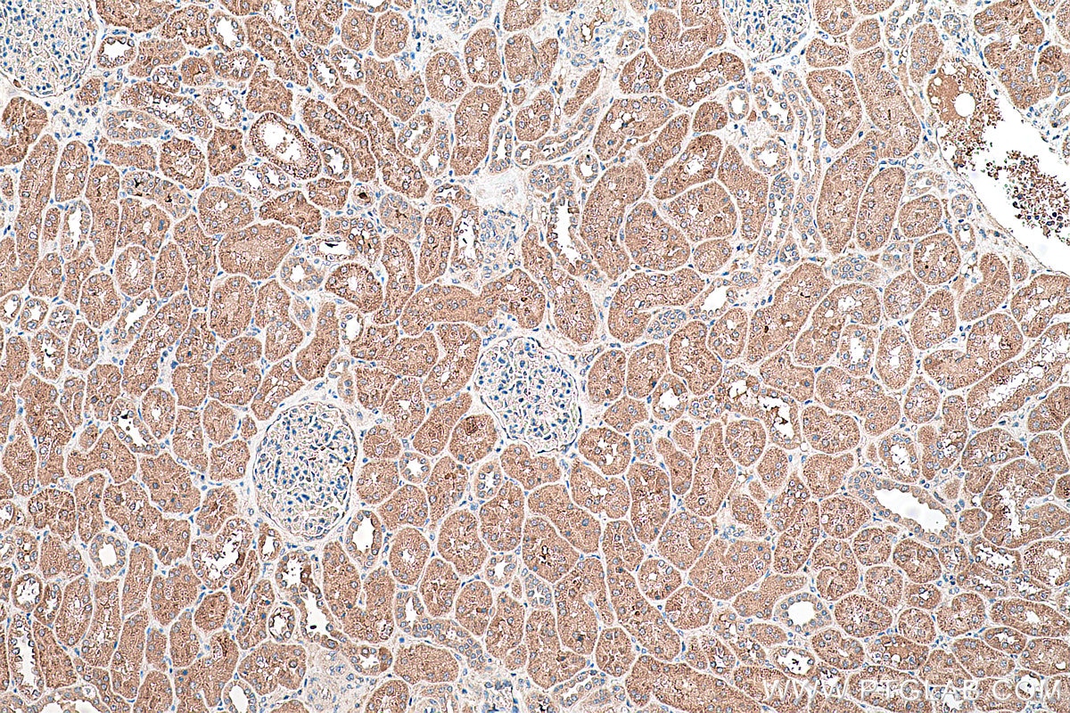 Immunohistochemical analysis of paraffin-embedded human kidney tissue slide using KHC0409 (CFH IHC Kit).