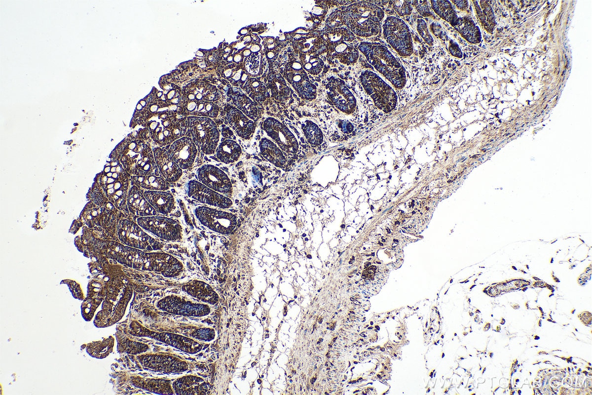 Immunohistochemical analysis of paraffin-embedded mouse colon tissue slide using KHC0534 (CFL1 IHC Kit).