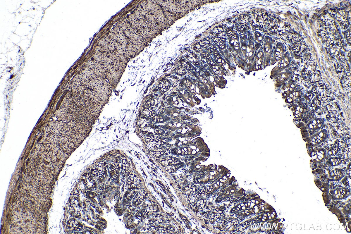 Immunohistochemical analysis of paraffin-embedded rat colon tissue slide using KHC0534 (CFL1 IHC Kit).