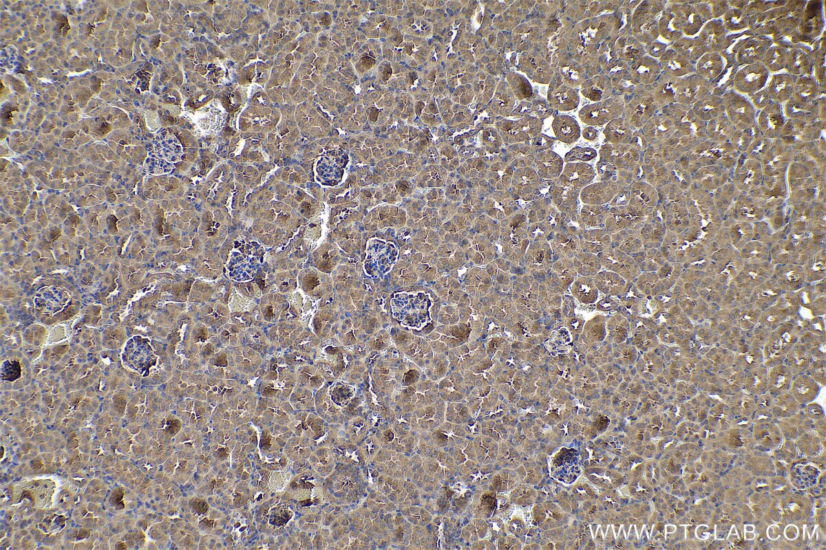 Immunohistochemical analysis of paraffin-embedded mouse kidney tissue slide using KHC0732 (CFL2 IHC Kit).