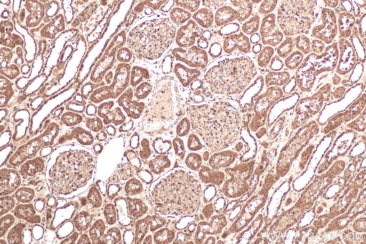 Immunohistochemical analysis of paraffin-embedded human kidney tissue slide using KHC0610 (CFLAR/FLIP IHC Kit).