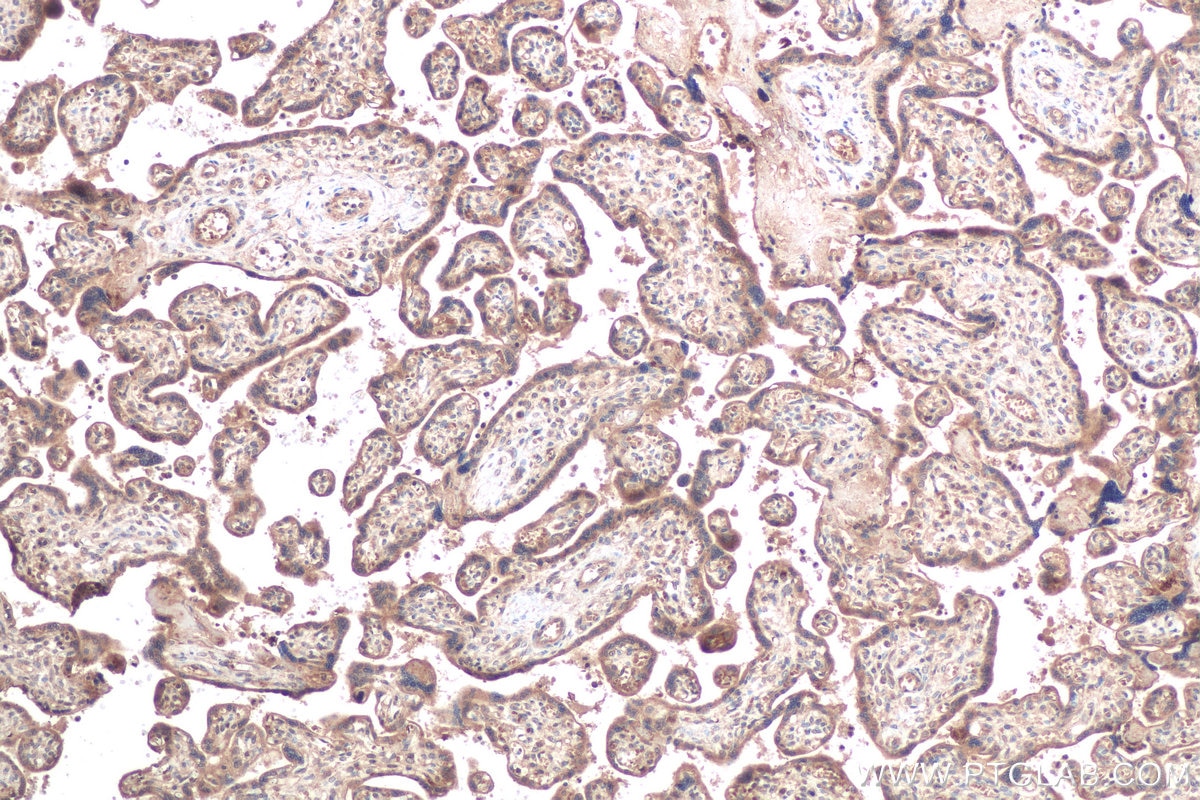 Immunohistochemical analysis of paraffin-embedded human placenta tissue slide using KHC0610 (CFLAR/FLIP IHC Kit).