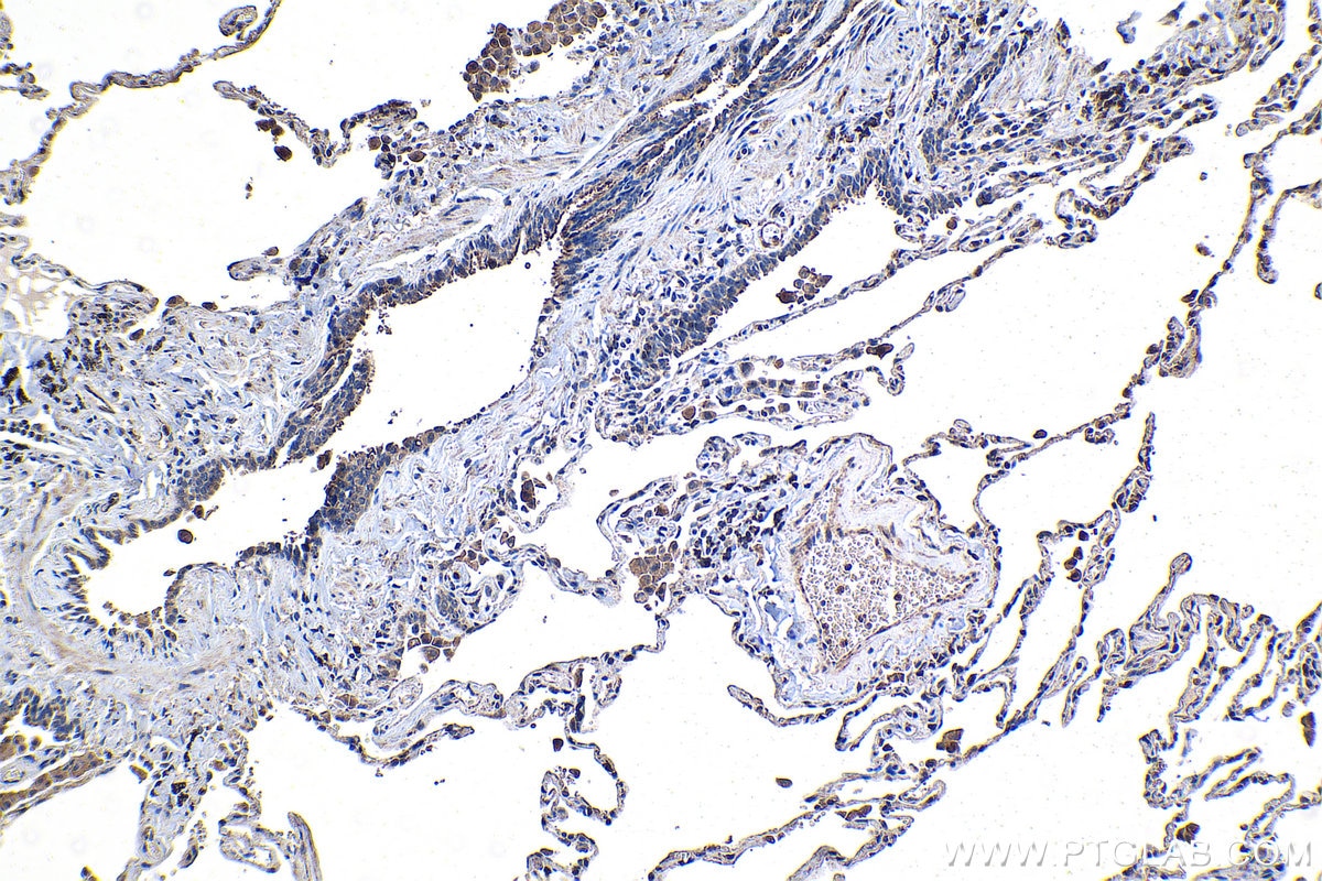 Immunohistochemical analysis of paraffin-embedded human lung tissue slide using KHC1322 (CFTR IHC Kit).