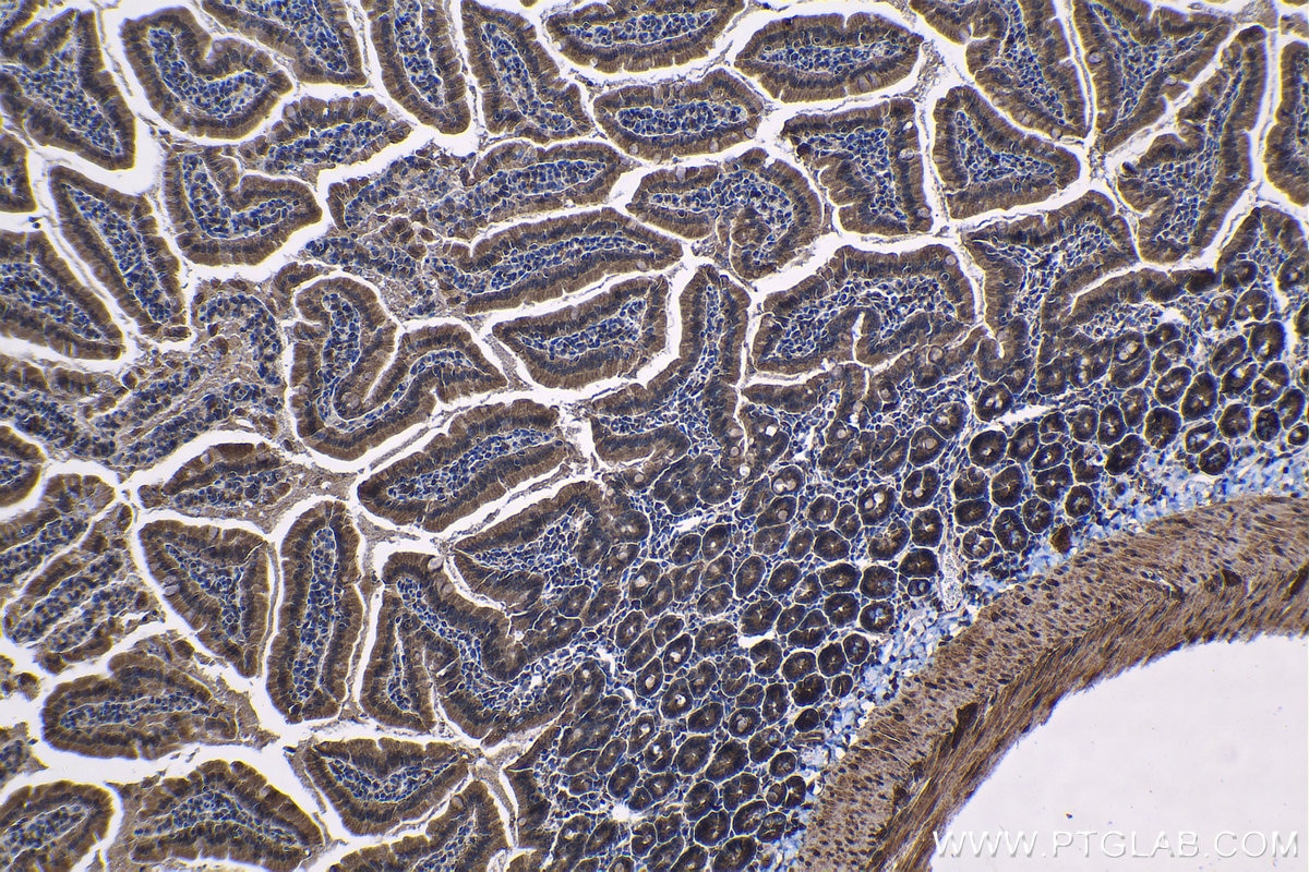 Immunohistochemical analysis of paraffin-embedded mouse small intestine tissue slide using KHC1322 (CFTR IHC Kit).