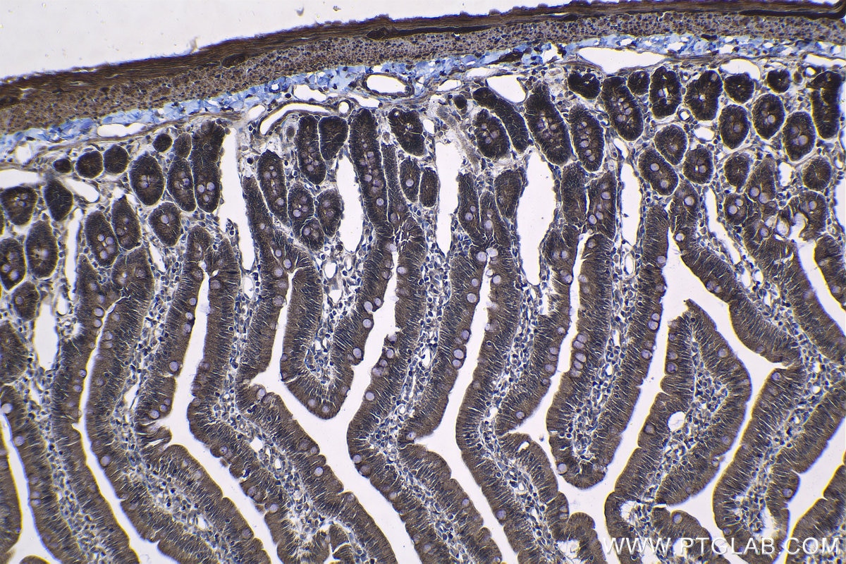 Immunohistochemical analysis of paraffin-embedded rat small intestine tissue slide using KHC1322 (CFTR IHC Kit).