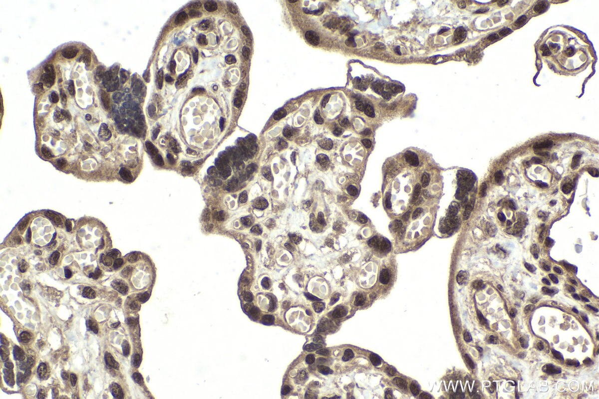 Immunohistochemical analysis of paraffin-embedded human placenta tissue slide using KHC1979 (CGGBP1 IHC Kit).