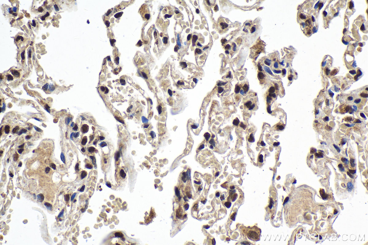 Immunohistochemical analysis of paraffin-embedded human lung tissue slide using KHC1979 (CGGBP1 IHC Kit).