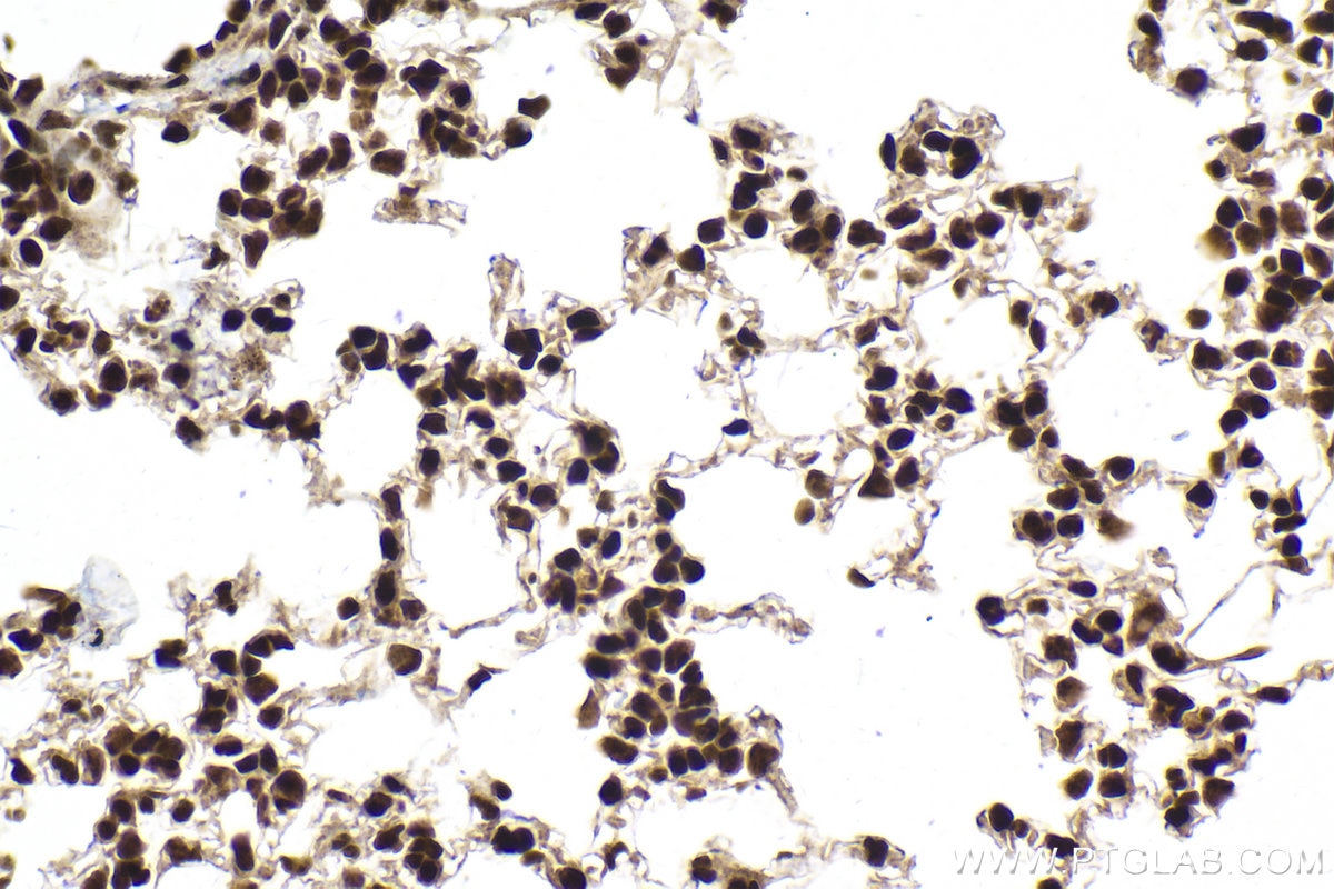 Immunohistochemical analysis of paraffin-embedded mouse lung tissue slide using KHC1979 (CGGBP1 IHC Kit).
