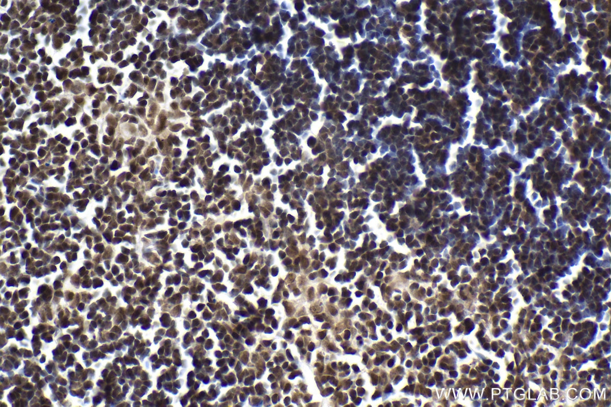 Immunohistochemical analysis of paraffin-embedded mouse thymus tissue slide using KHC1979 (CGGBP1 IHC Kit).