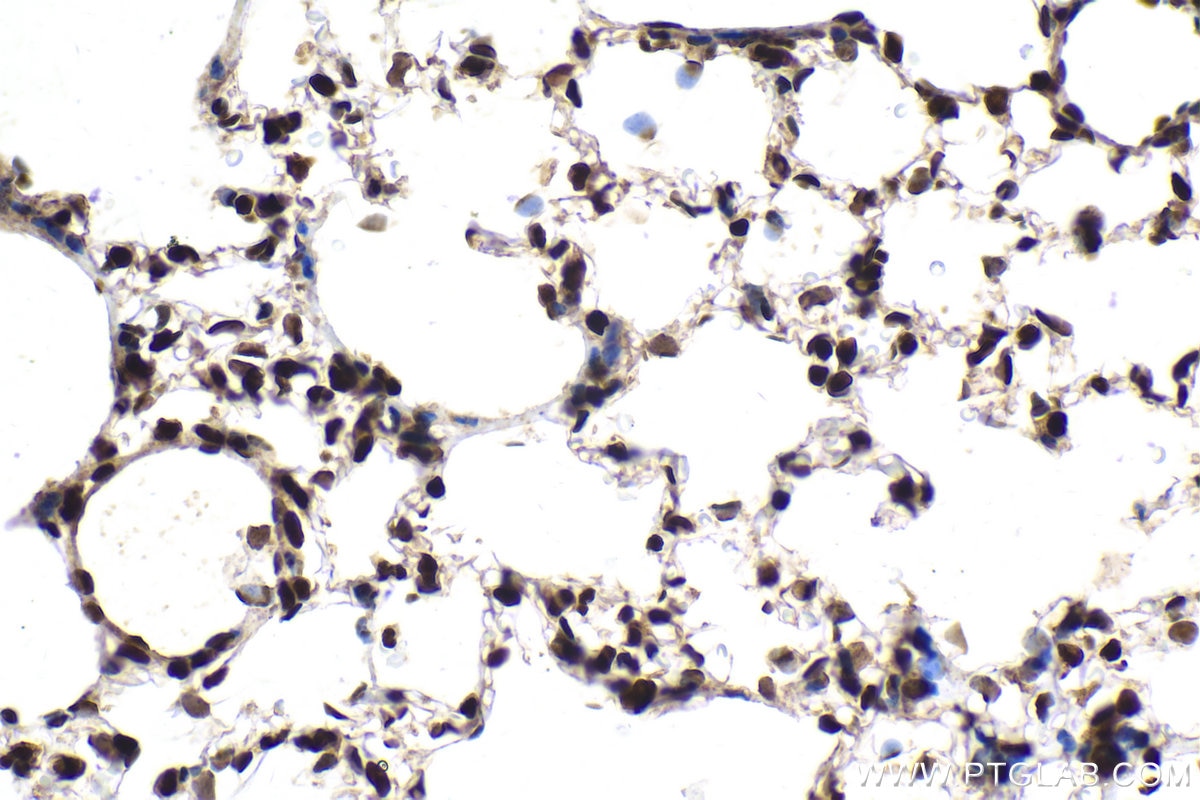 Immunohistochemical analysis of paraffin-embedded rat lung tissue slide using KHC1979 (CGGBP1 IHC Kit).