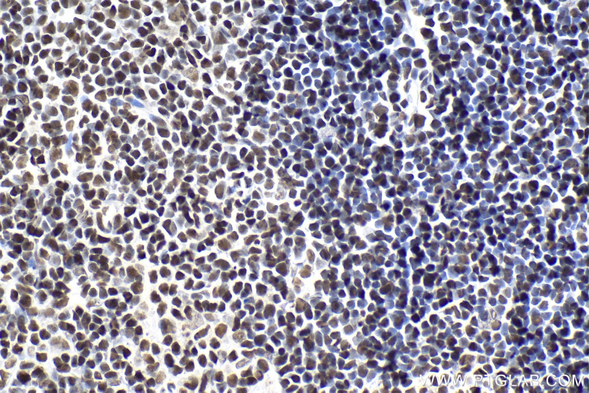 Immunohistochemical analysis of paraffin-embedded rat thymus tissue slide using KHC1979 (CGGBP1 IHC Kit).