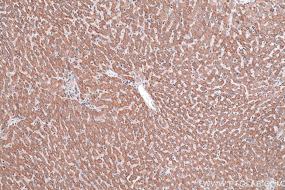 Immunohistochemical analysis of paraffin-embedded human liver tissue slide using KHC0410 (CHCHD2 IHC Kit).