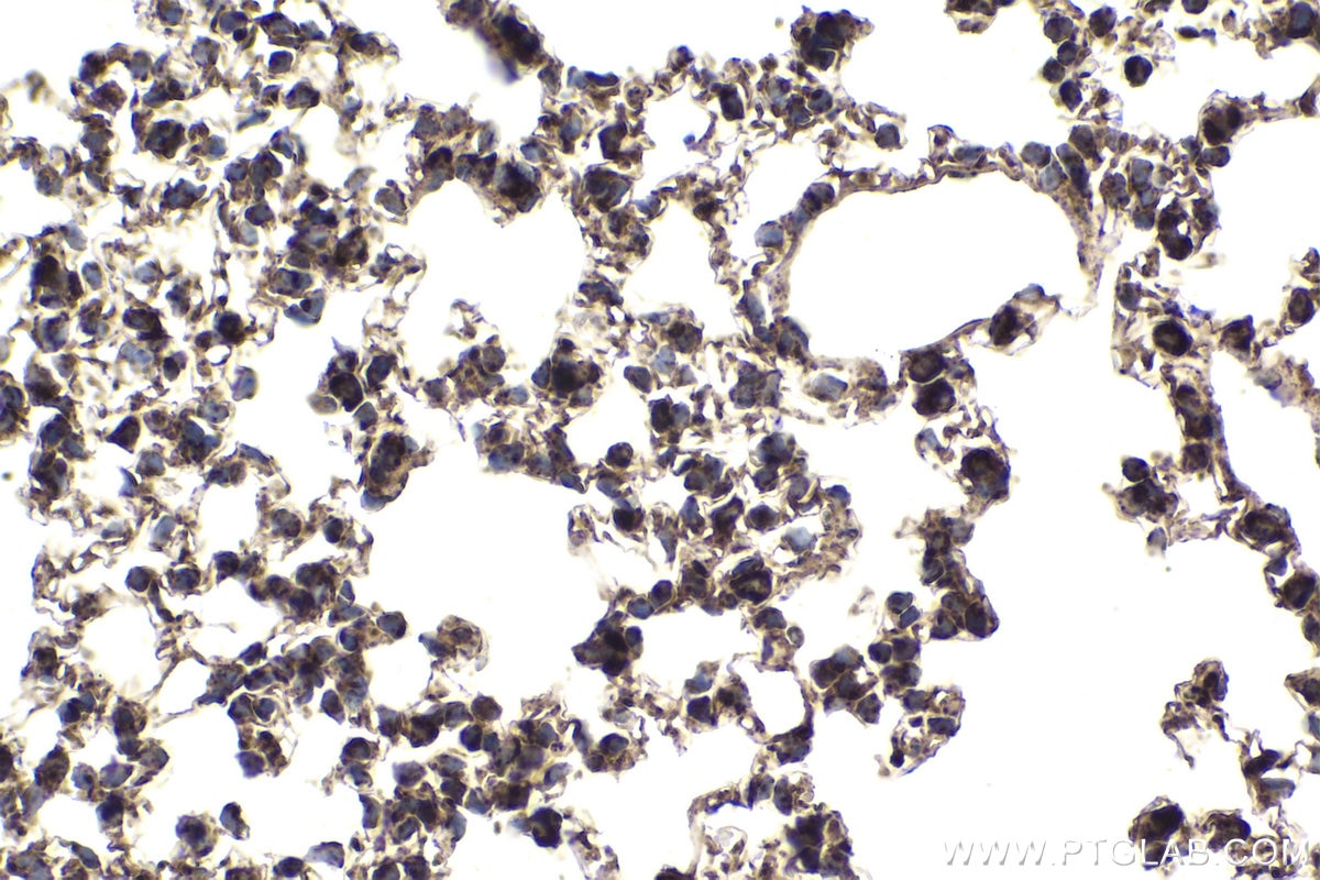 Immunohistochemical analysis of paraffin-embedded mouse lung tissue slide using KHC1970 (CHCHD3 IHC Kit).