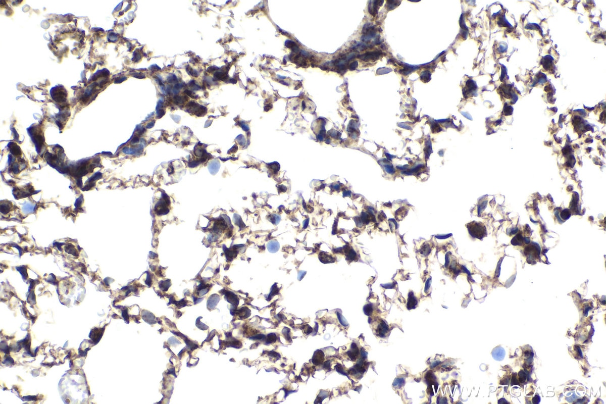 Immunohistochemical analysis of paraffin-embedded rat lung tissue slide using KHC1970 (CHCHD3 IHC Kit).