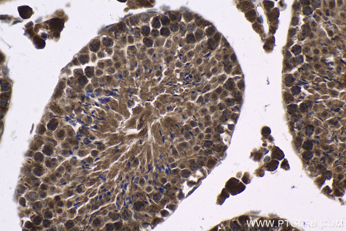 Immunohistochemical analysis of paraffin-embedded mouse testis tissue slide using KHC1425 (CHD1 IHC Kit).