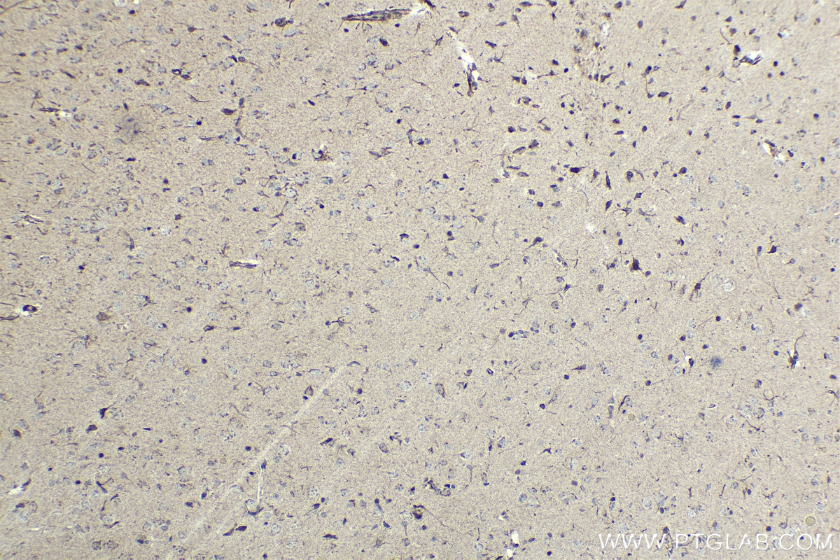 Immunohistochemical analysis of paraffin-embedded rat brain tissue slide using KHC1425 (CHD1 IHC Kit).