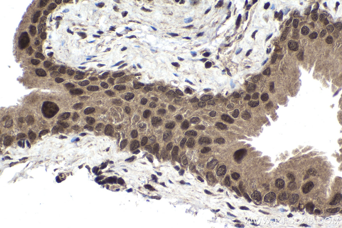 Immunohistochemical analysis of paraffin-embedded mouse bladder tissue slide using KHC1694 (CHD3 IHC Kit).