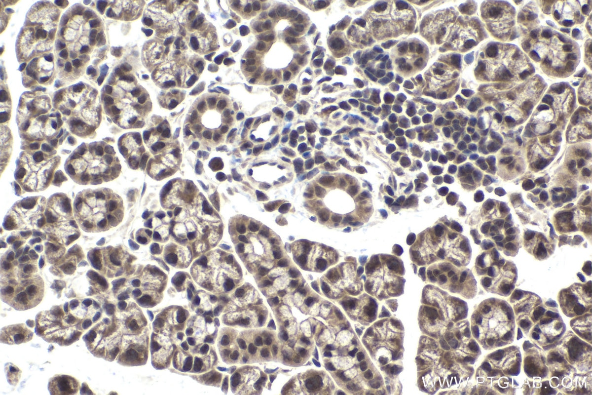 Immunohistochemical analysis of paraffin-embedded mouse salivary gland tissue slide using KHC1694 (CHD3 IHC Kit).