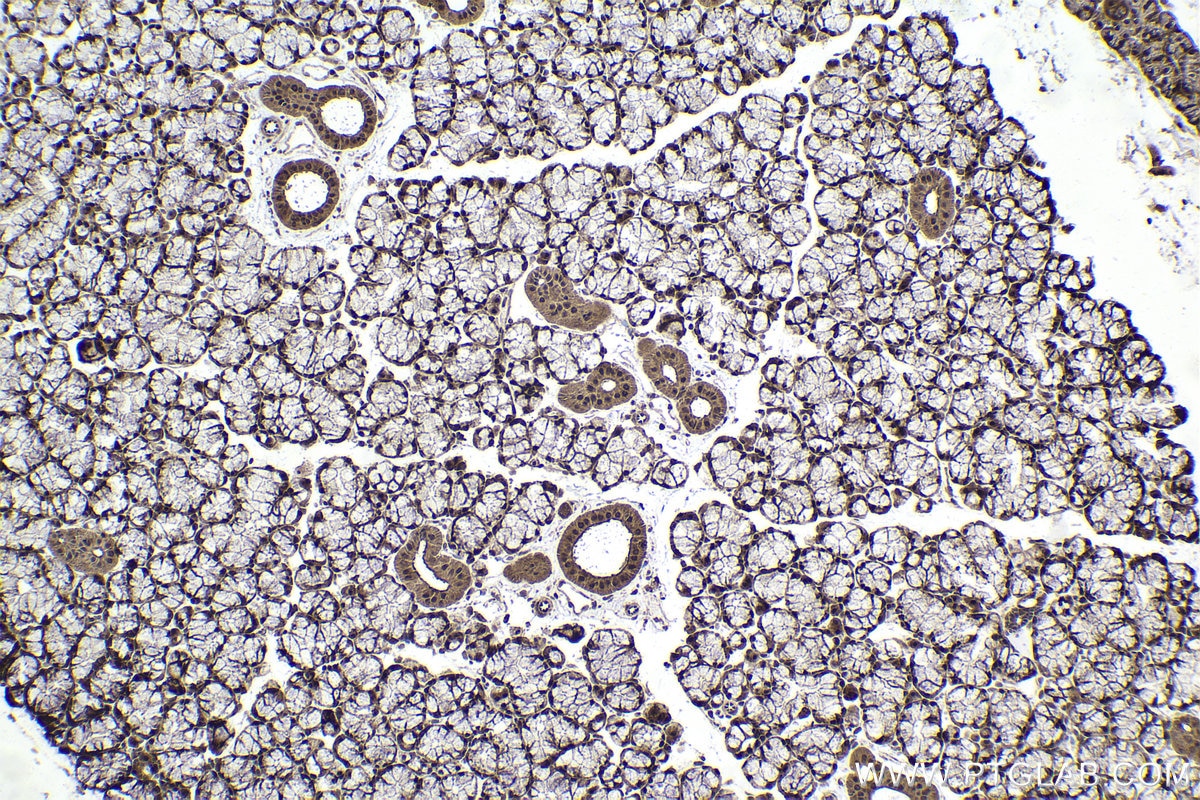 Immunohistochemical analysis of paraffin-embedded rat salivary gland tissue slide using KHC1694 (CHD3 IHC Kit).