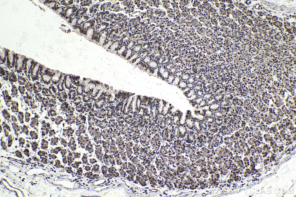Immunohistochemical analysis of paraffin-embedded rat stomach tissue slide using KHC1737 (CHD4 IHC Kit).