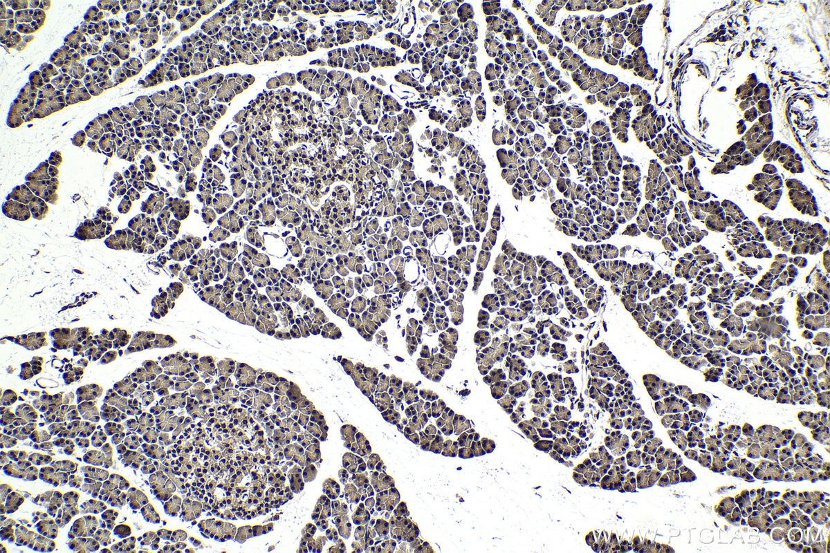 Immunohistochemical analysis of paraffin-embedded rat pancreas tissue slide using KHC1737 (CHD4 IHC Kit).