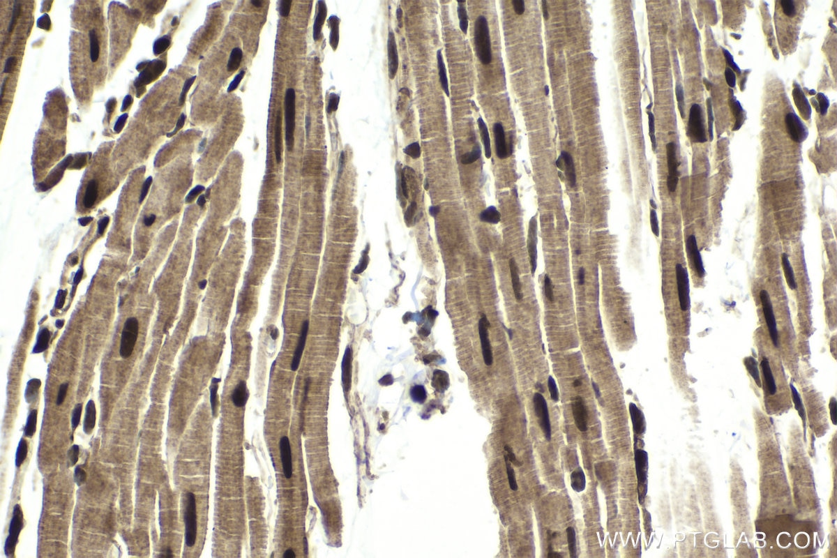 Immunohistochemical analysis of paraffin-embedded rat heart tissue slide using KHC1737 (CHD4 IHC Kit).