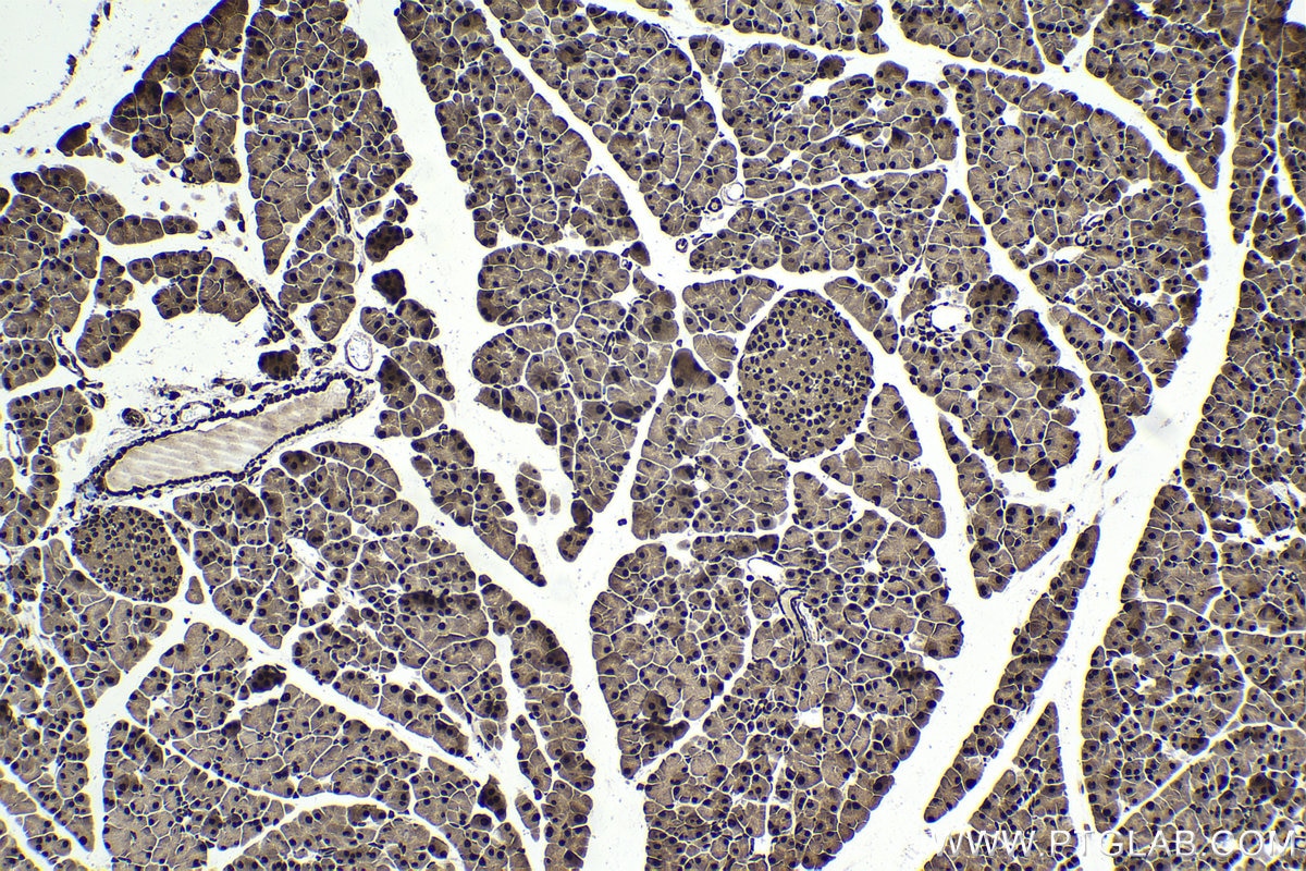 Immunohistochemical analysis of paraffin-embedded mouse pancreas tissue slide using KHC1737 (CHD4 IHC Kit).