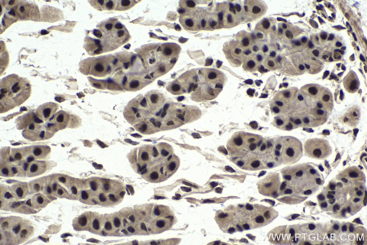 Immunohistochemical analysis of paraffin-embedded mouse stomach tissue slide using KHC1737 (CHD4 IHC Kit).