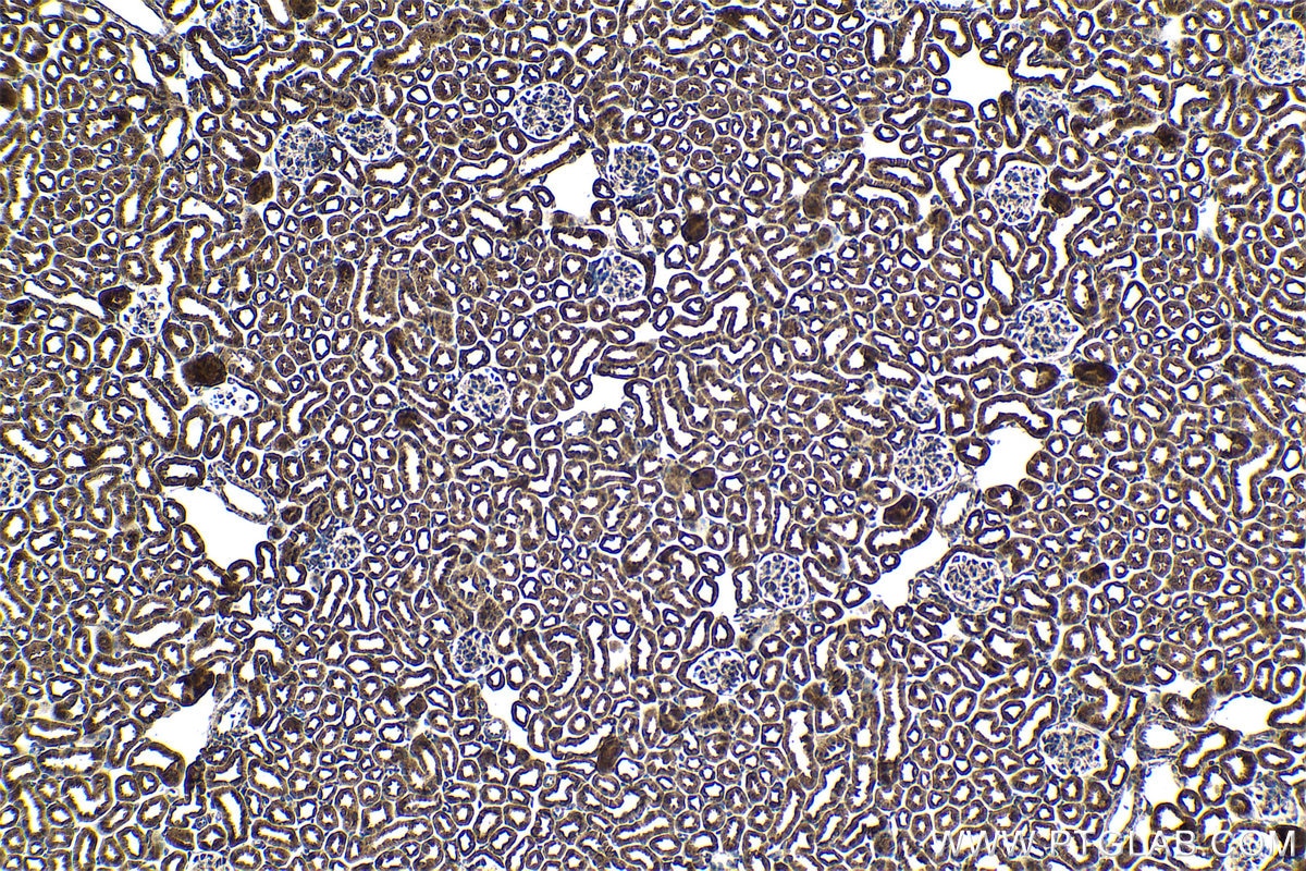 Immunohistochemical analysis of paraffin-embedded mouse kidney tissue slide using KHC1769 (CHD9 IHC Kit).