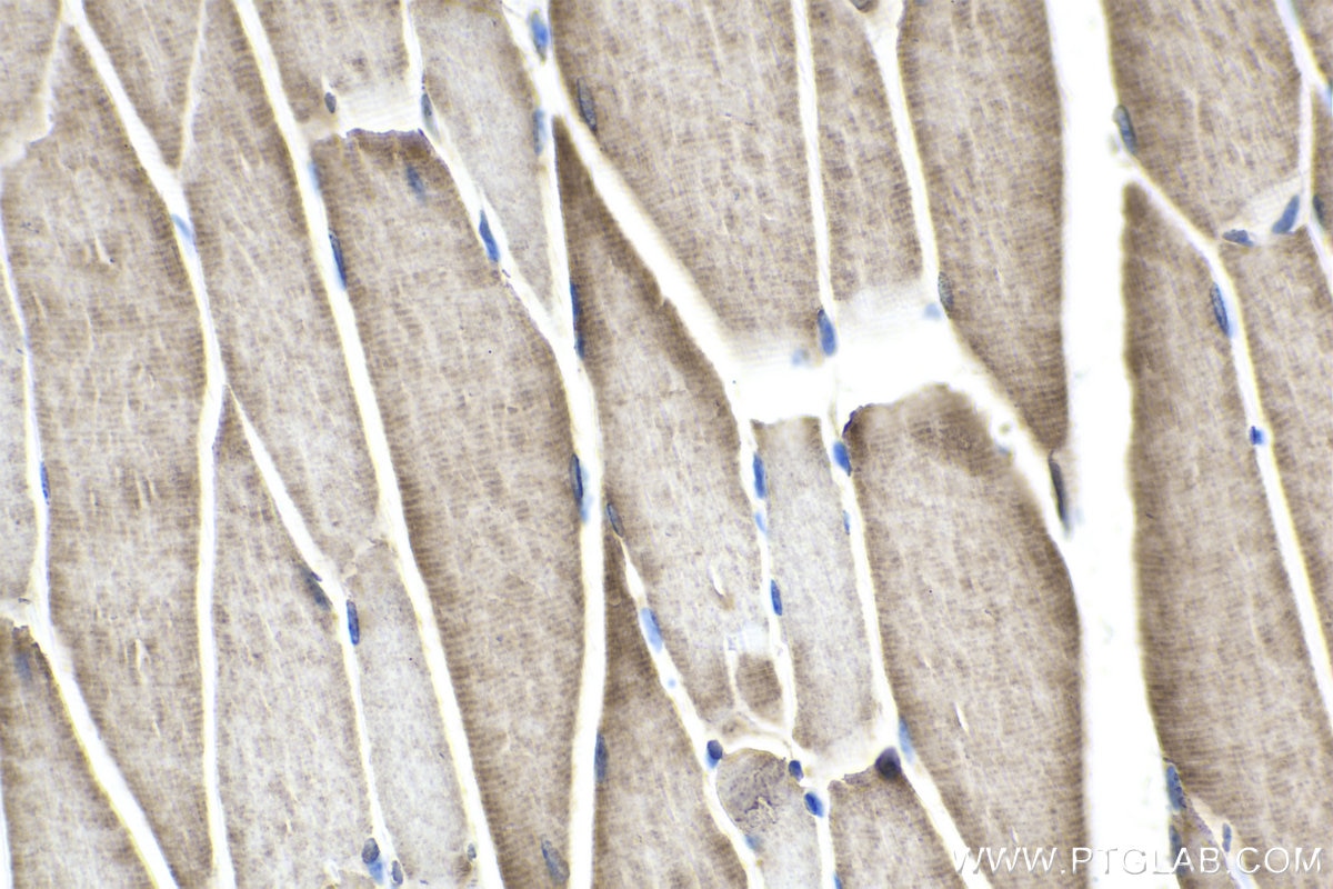 Immunohistochemical analysis of paraffin-embedded mouse skeletal muscle tissue slide using KHC1769 (CHD9 IHC Kit).