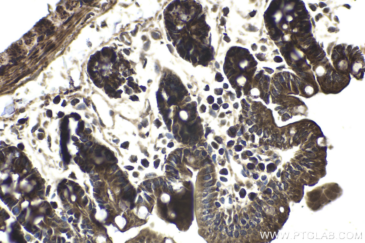 Immunohistochemical analysis of paraffin-embedded mouse small intestine tissue slide using KHC1769 (CHD9 IHC Kit).