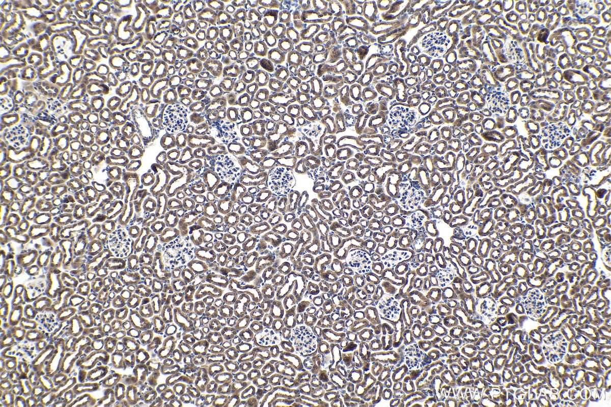 Immunohistochemical analysis of paraffin-embedded mouse kidney tissue slide using KHC1455 (CHMP2A IHC Kit).