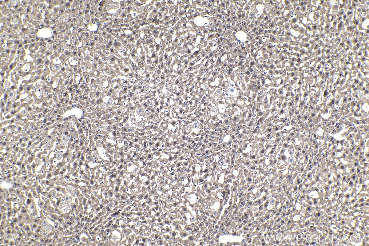 Immunohistochemical analysis of paraffin-embedded mouse liver tissue slide using KHC1455 (CHMP2A IHC Kit).
