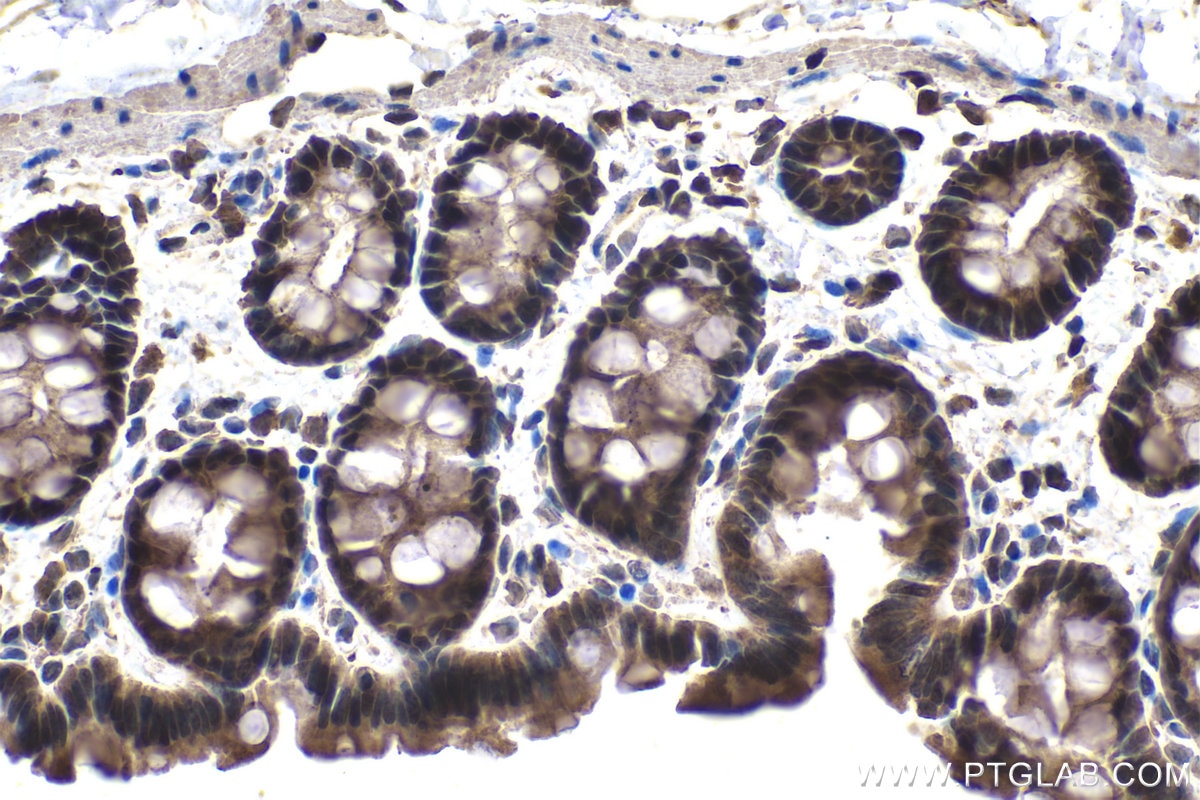 Immunohistochemical analysis of paraffin-embedded rat colon tissue slide using KHC1455 (CHMP2A IHC Kit).