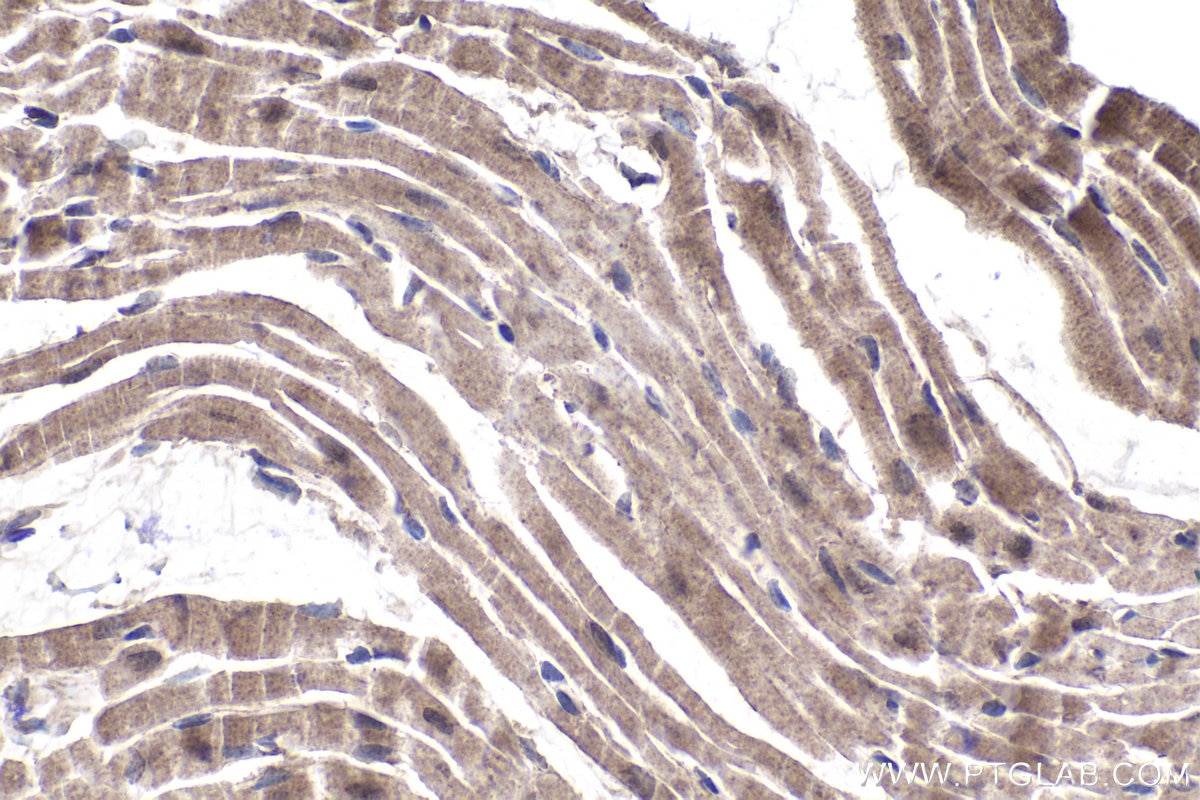 Immunohistochemical analysis of paraffin-embedded mouse heart tissue slide using KHC1930 (CHMP4B IHC Kit).