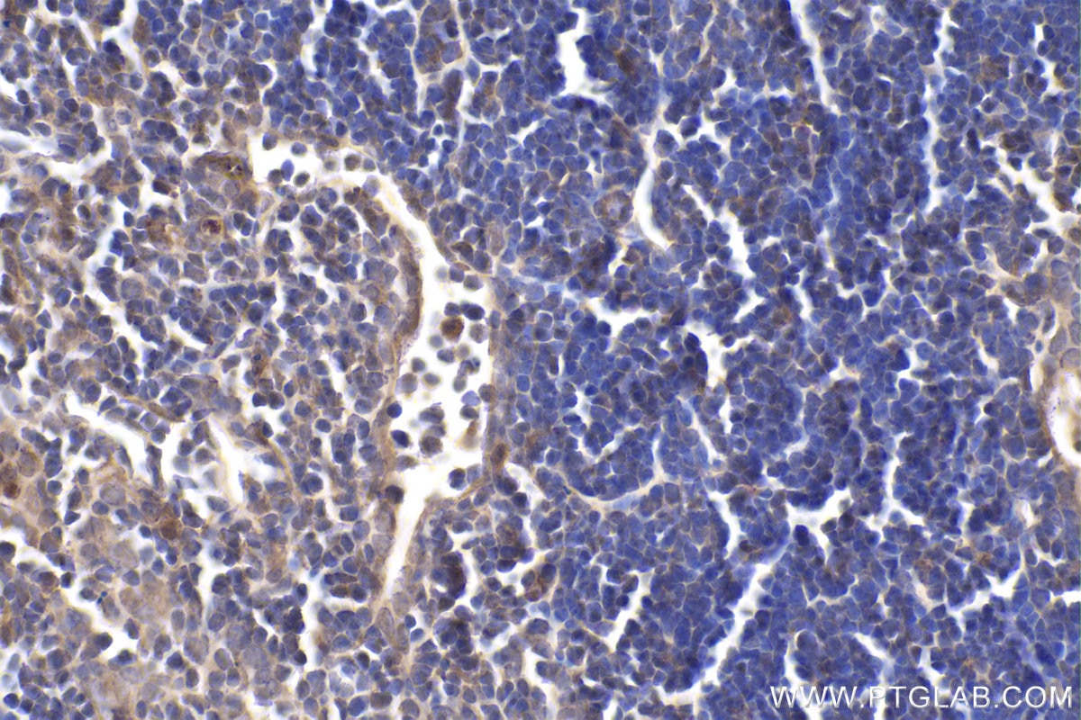 Immunohistochemical analysis of paraffin-embedded mouse thymus tissue slide using KHC1930 (CHMP4B IHC Kit).